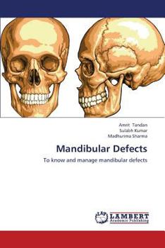 Paperback Mandibular Defects Book