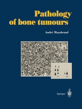 Paperback Pathology of Bone Tumours: Personal Experience Book