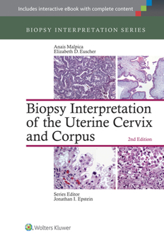 Hardcover Biopsy Interpretation of the Uterine Cervix and Corpus Book