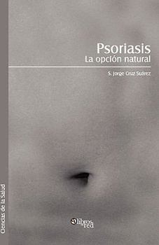 Paperback Psoriasis. La Opcion Natural (Spanish Edition) [Spanish] Book