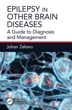 Paperback Epilepsy in Other Brain Diseases: A Guide to Diagnosis and Management Book