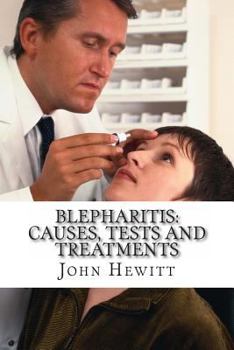 Paperback Blepharitis: Causes, Tests and Treatment Book