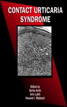 Hardcover Contact Urticaria Syndrome Book