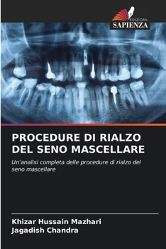 Paperback Procedure Di Rialzo del Seno Mascellare [Italian] Book