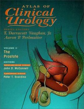 Hardcover Atlas of Clinical Urology, Volume 2: The Prostate Book