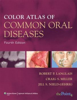 Paperback Color Atlas of Common Oral Diseases Book