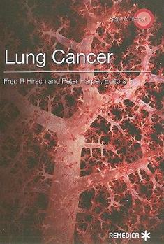 Paperback Lung Cancer Book