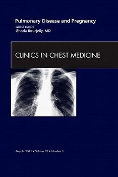 Hardcover Pulmonary Disease and Pregnancy, an Issue of Clinics in Chest Medicine: Volume 32-1 Book