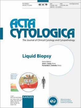 Paperback Liquid Biopsy Book