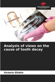 Paperback Analysis of views on the cause of tooth decay Book