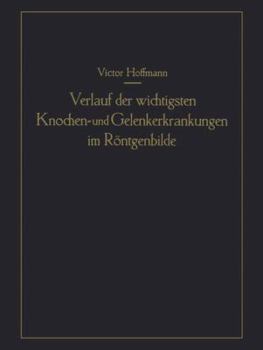 Paperback Verlauf Der Wichtigsten Knochen- Und Gelenkerkrankungen Im Röntgenbilde: Eine Anschauliche Prognostik [German] Book
