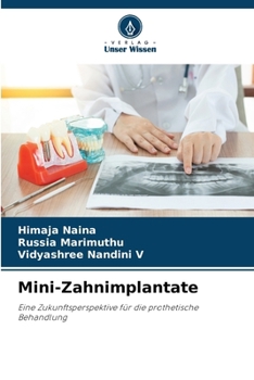 Paperback Mini-Zahnimplantate [German] Book