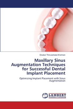 Paperback Maxillary Sinus Augmentation Techniques for Successful Dental Implant Placement Book