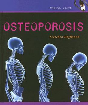 Osteoporosis - Book  of the Health Alert
