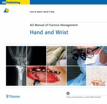 Hardcover AO Manual of Fracture Management - Hand and Wrist (Ao Manuel of Fracture Management) Book