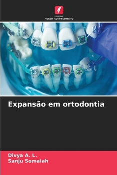 Paperback Expansão em ortodontia [Portuguese] Book