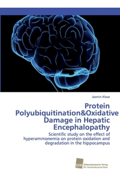 Paperback Protein Polyubiquitination&Oxidative Damage in Hepatic Encephalopathy Book