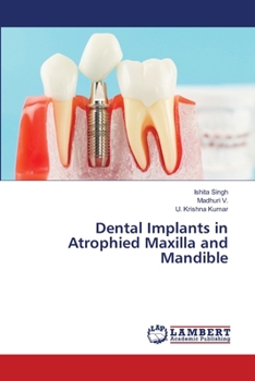 Dental Implants in Atrophied Maxilla and Mandible