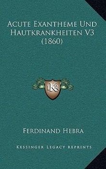 Acute Exantheme Und Hautkrankheiten V3 (1860)