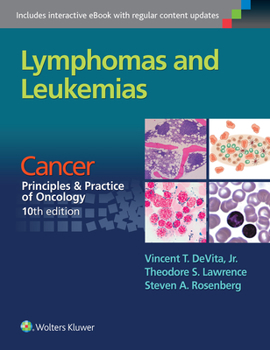 Paperback Lymphomas and Leukemias: Cancer: Principles & Practice of Oncology, 10th Edition Book