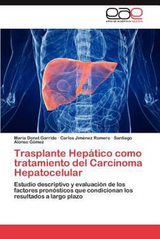 Paperback Trasplante Hepático como tratamiento del Carcinoma Hepatocelular [Spanish] Book