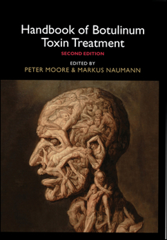 Hardcover Handbook of Botulinum Toxin Treatment Book
