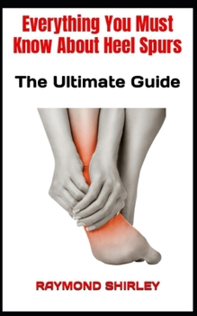 Paperback Everything You Must Know About Heel Spurs: The Ultimate Guide Book