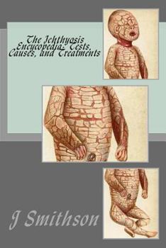 Paperback The Ichthyosis Encycopedia: Tests, Causes, and Treatments Book