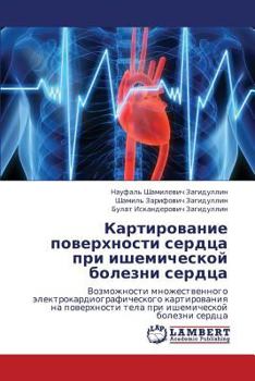 Paperback Kartirovanie Poverkhnosti Serdtsa Pri Ishemicheskoy Bolezni Serdtsa [Russian] Book
