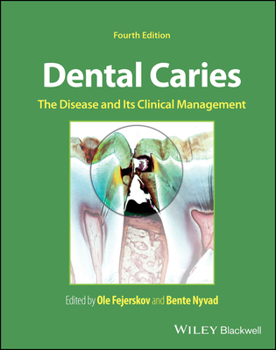 Hardcover Dental Caries: The Disease and Its Clinical Management Book