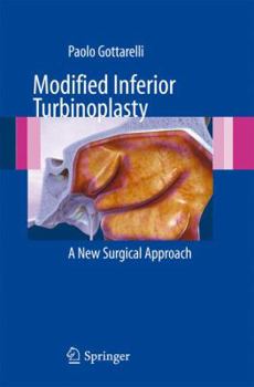 Paperback Modified Inferior Turbinoplasty: A New Surgical Approach Book