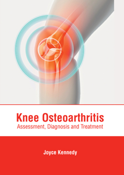 Hardcover Knee Osteoarthritis: Assessment, Diagnosis and Treatment Book