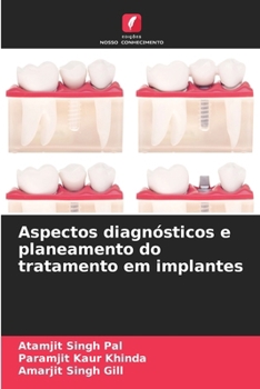Paperback Aspectos diagnósticos e planeamento do tratamento em implantes [Portuguese] Book