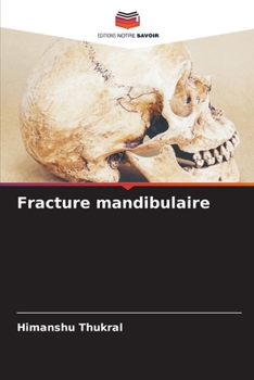 Paperback Fracture mandibulaire [French] Book