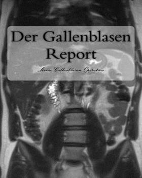Paperback Der Gallenblasen Report: Meine Gallenblasen Operation [German] Book