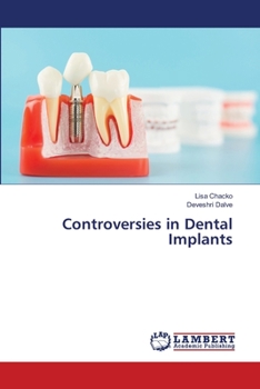 Paperback Controversies in Dental Implants Book