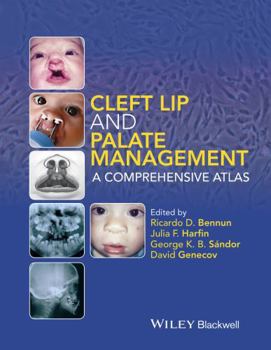 Hardcover Cleft Lip and Palate Management: A Comprehensive Atlas Book