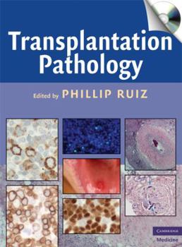 Hardcover Transplantation Pathology Book