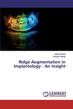 Paperback Ridge Augmentation in Implantology - An Insight Book