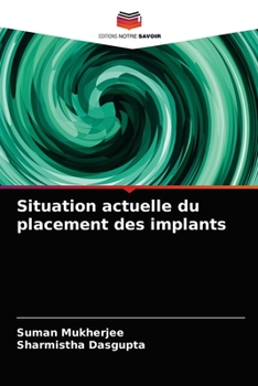 Paperback Situation actuelle du placement des implants [French] Book