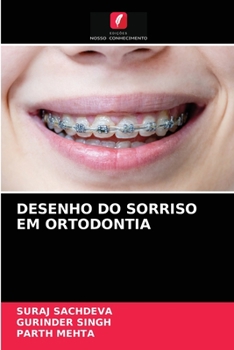 Paperback Desenho Do Sorriso Em Ortodontia [Portuguese] Book