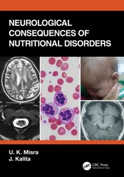Paperback Neurological Consequences of Nutritional Disorders Book