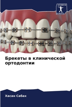 Брекеты в клинической ор