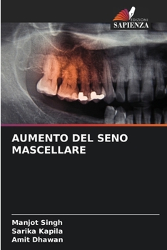 Paperback Aumento del Seno Mascellare [Italian] Book