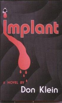 Hardcover Implant Book