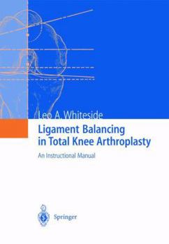 Paperback Ligament Balancing in Total Knee Arthroplasty: An Instructional Manual Book