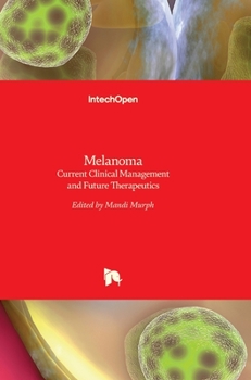 Hardcover Melanoma: Current Clinical Management and Future Therapeutics Book