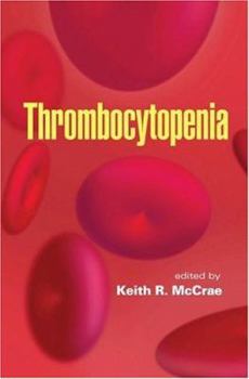Hardcover Thrombocytopenia (Basic and Clinical Oncology) Book