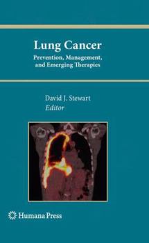 Lung Cancer: Prevention, Management, and Emerging Therapies