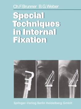 Paperback Special Techniques in Internal Fixation Book